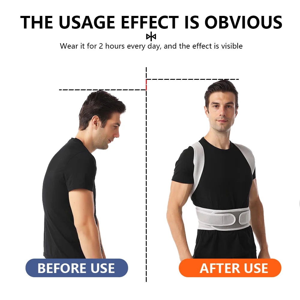 Adjustable Scoliosis Posture Corrector Corset Belt