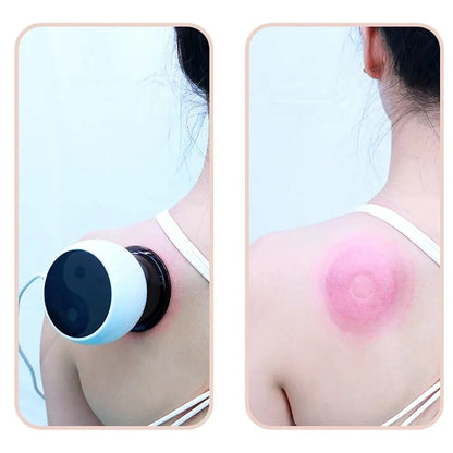 Visual Display Smart LCD Massager Electric Heating Remote Controller Vacuum Cupping Massager Suction Cup LCD Screen