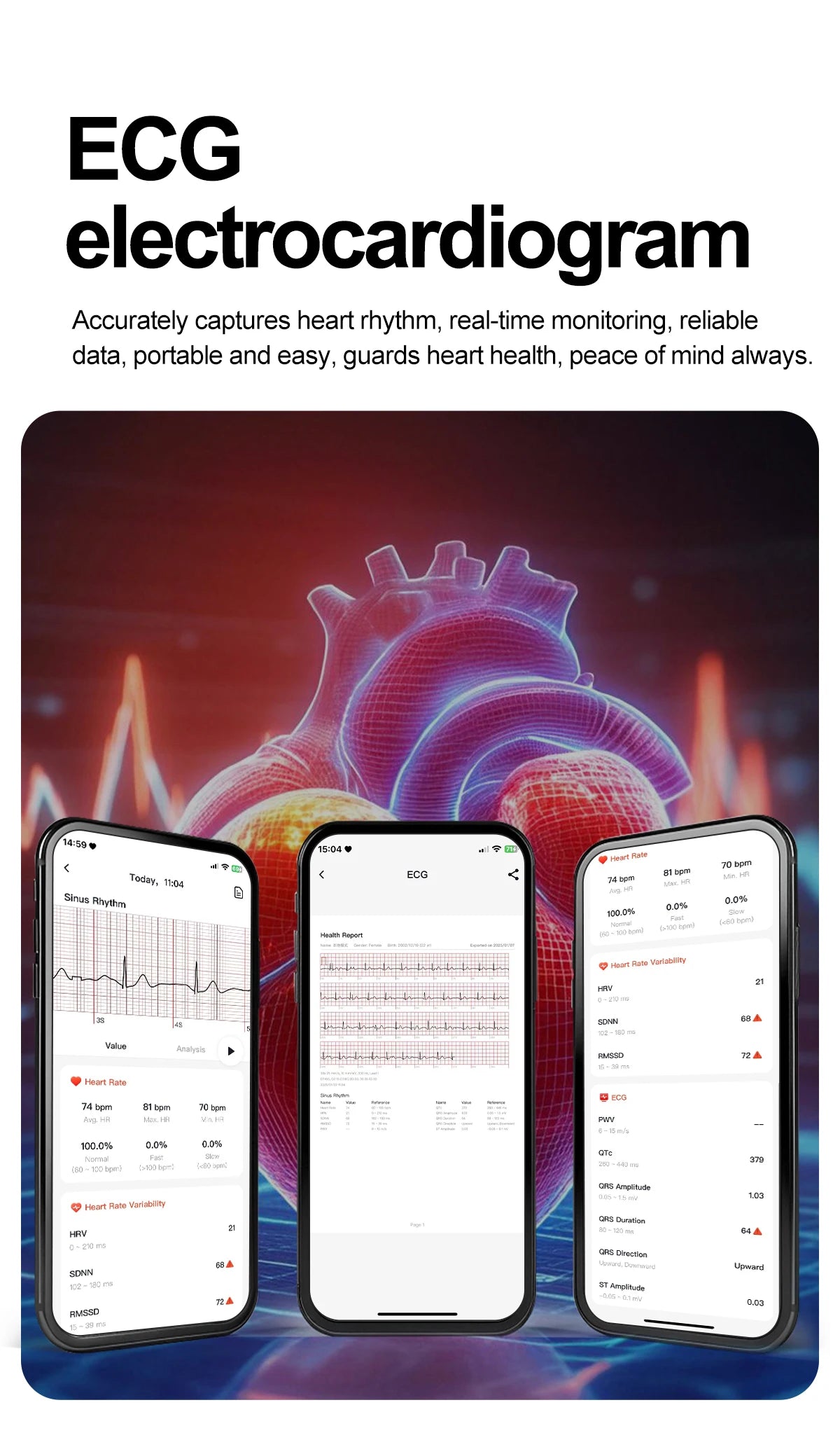 2025 New Accurate ECG Smart Watch Heart Health Analysis Blood analysis Blood Lipid Blood Pressure BT call Smart Watches For Men